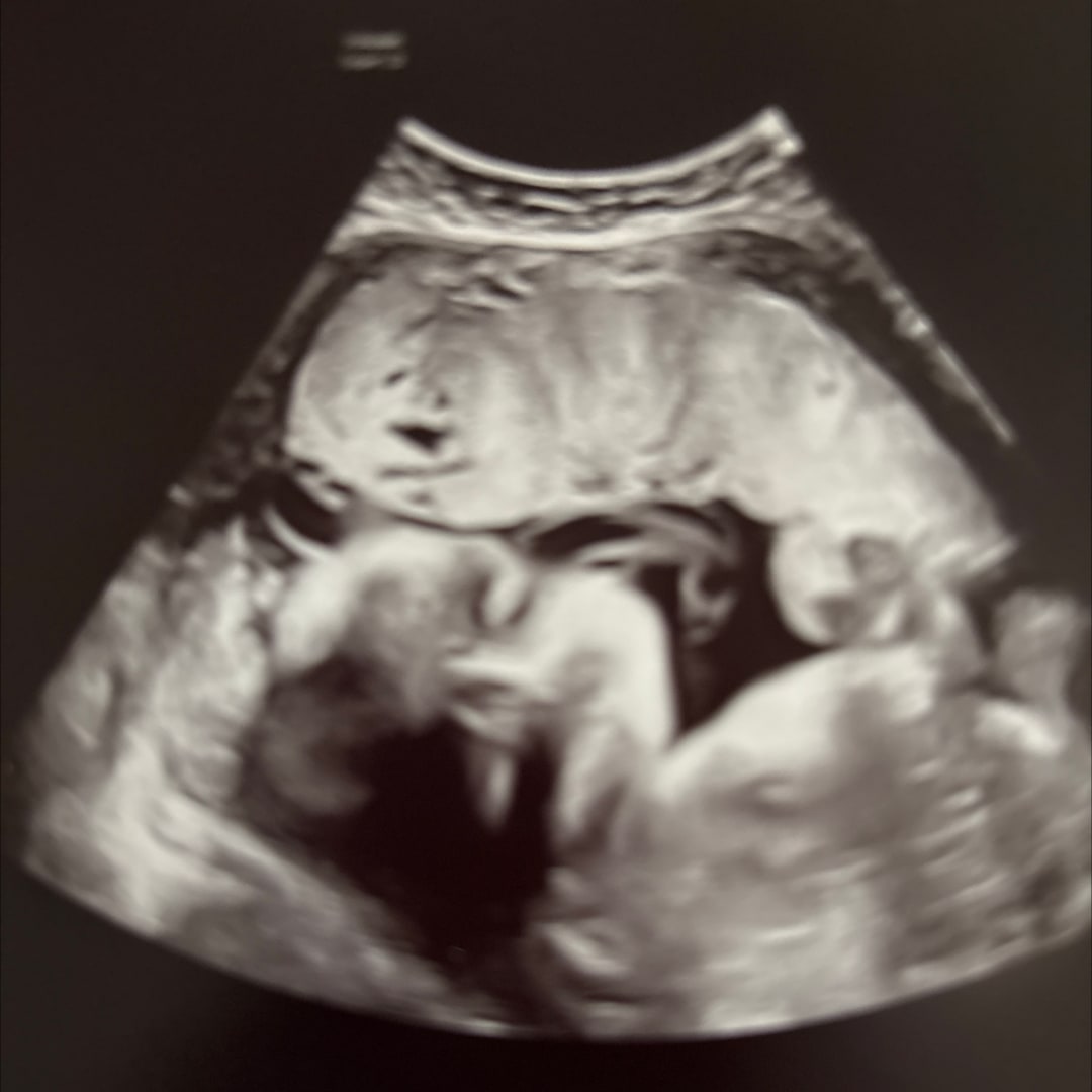 Photo shared by Tiffany for their Babylist baby registry.