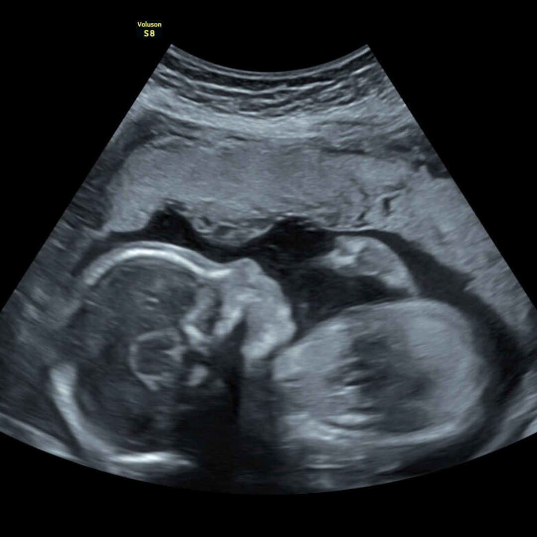 Photo shared by Kennedy for their Babylist baby registry.