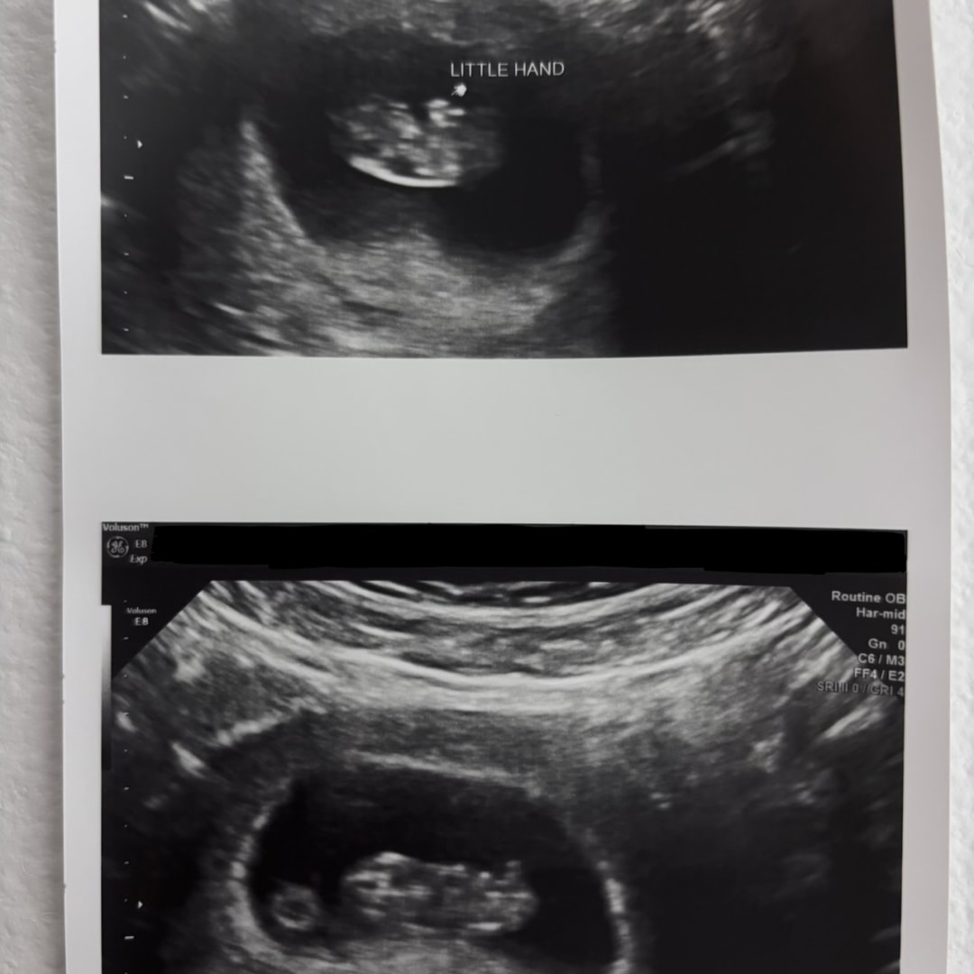 Photo shared by Alexa for their Babylist baby registry.