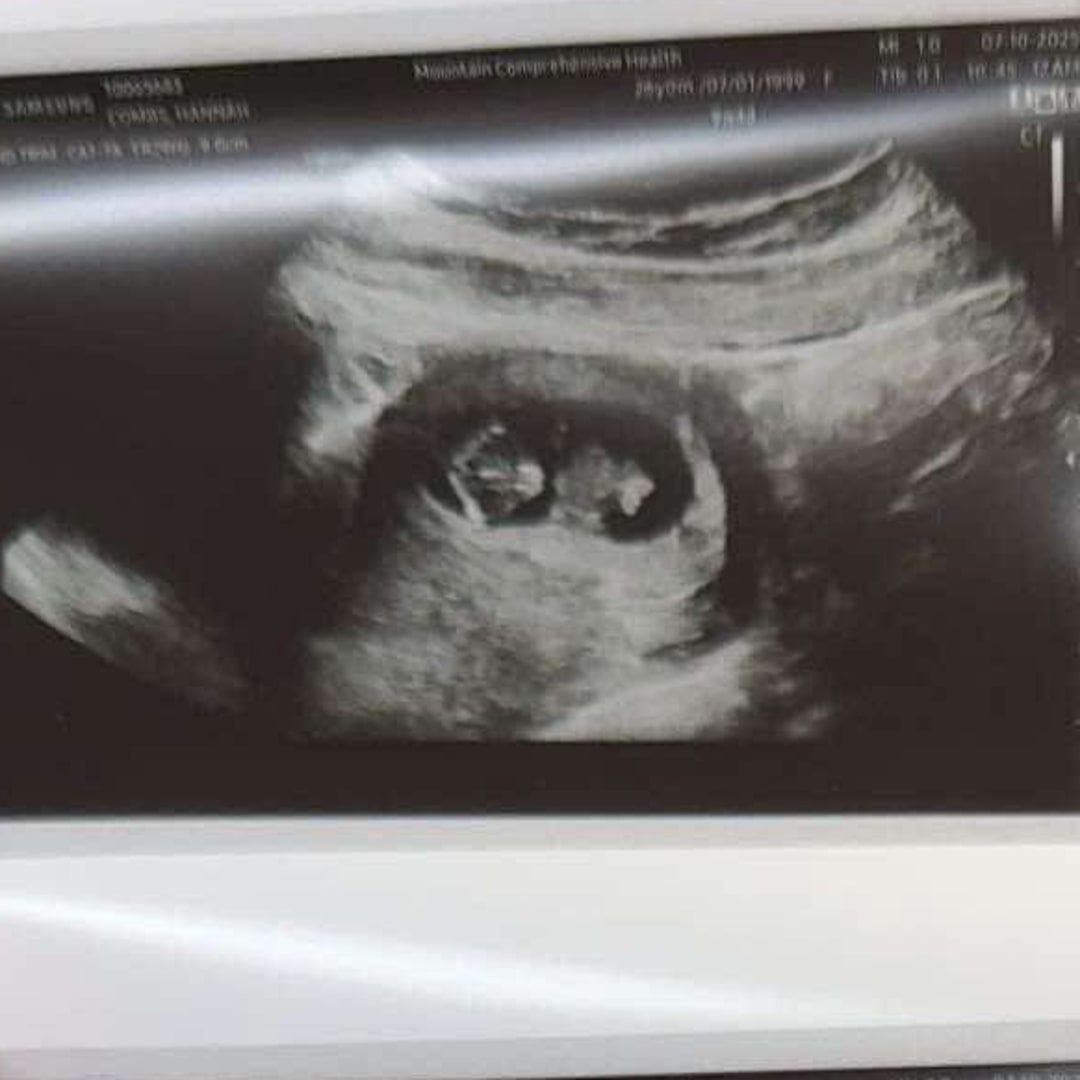 Photo shared by Hannah for their Babylist baby registry.