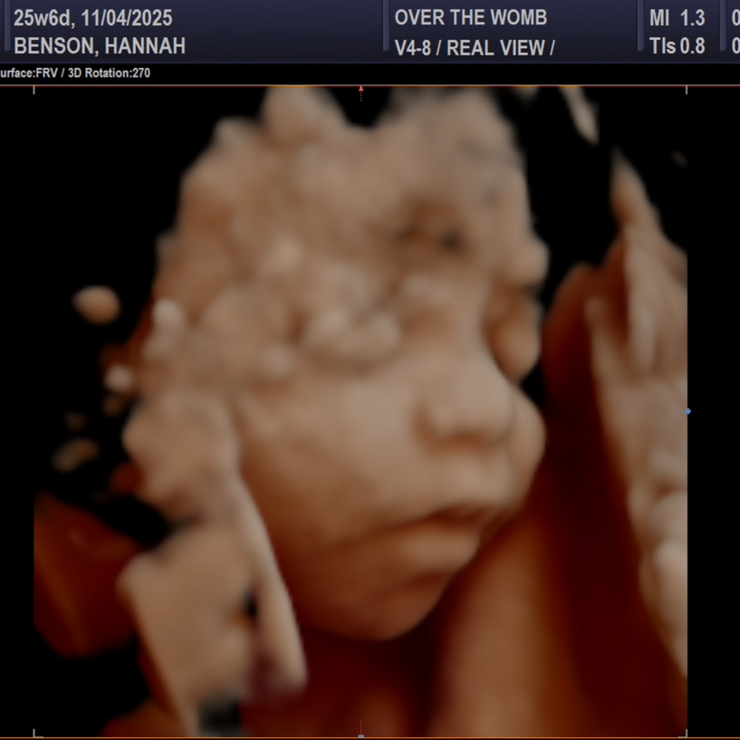 Photo shared by Hannah for their Babylist baby registry.