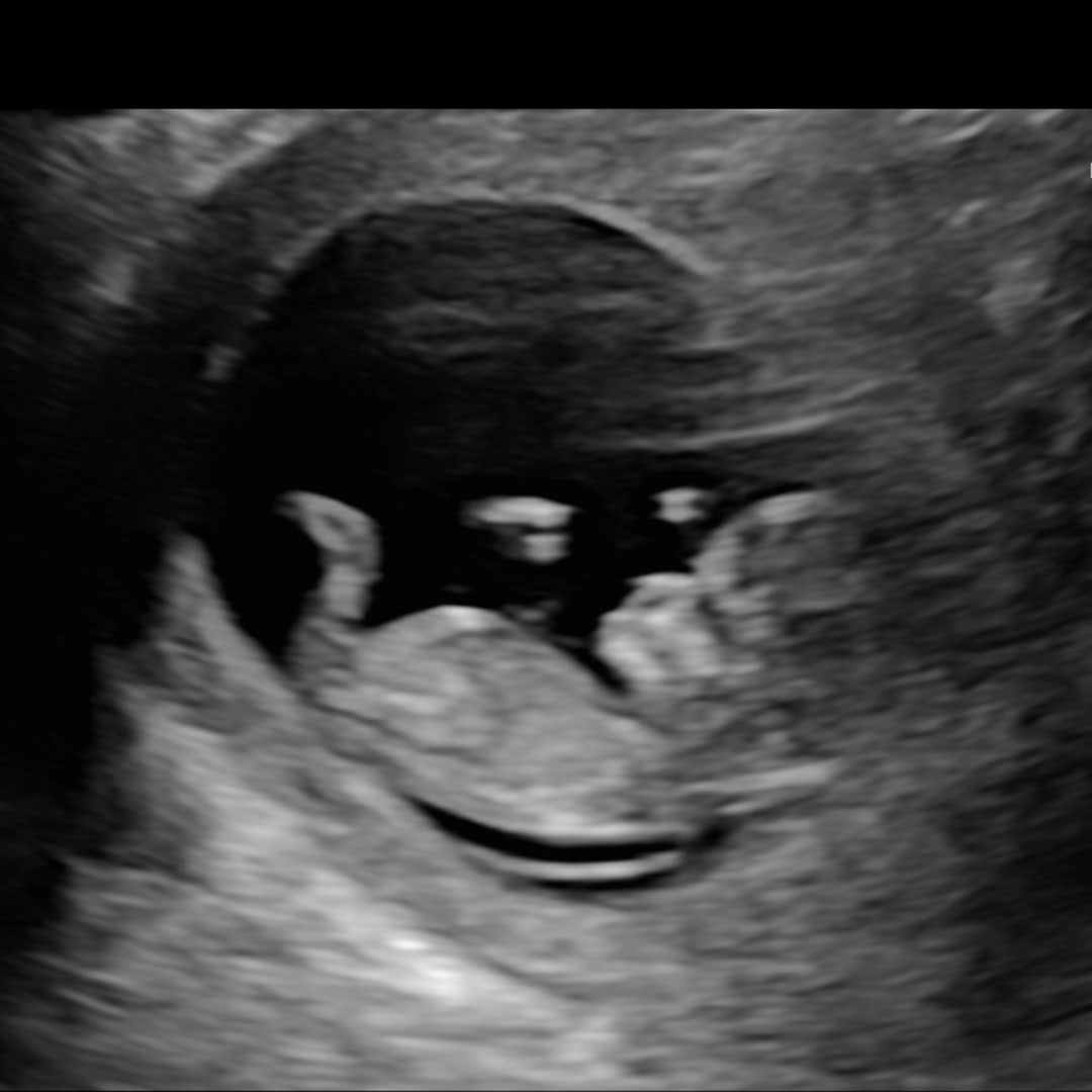 Photo shared by Amanda for their Babylist baby registry.