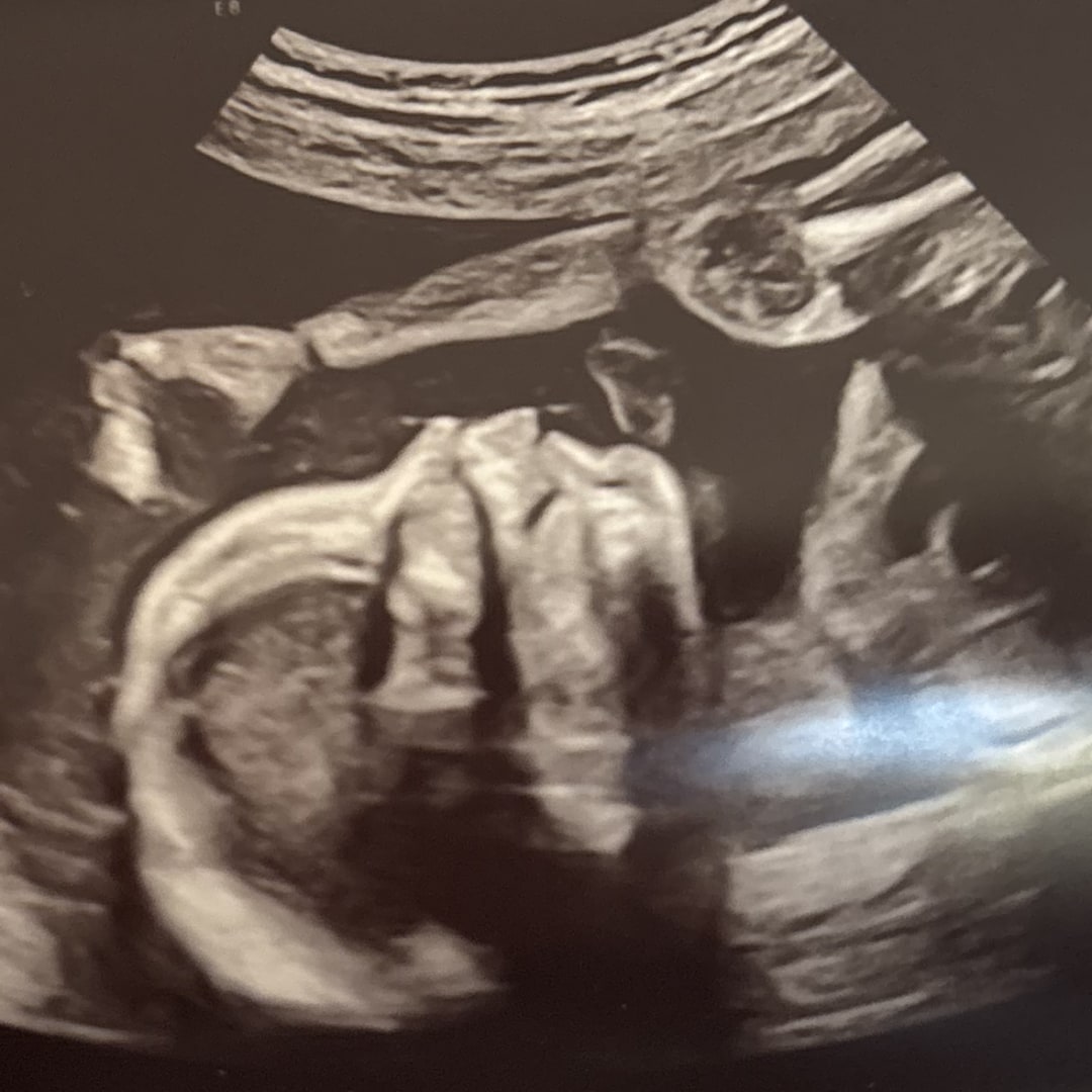 Photo shared by Amanda for their Babylist baby registry.