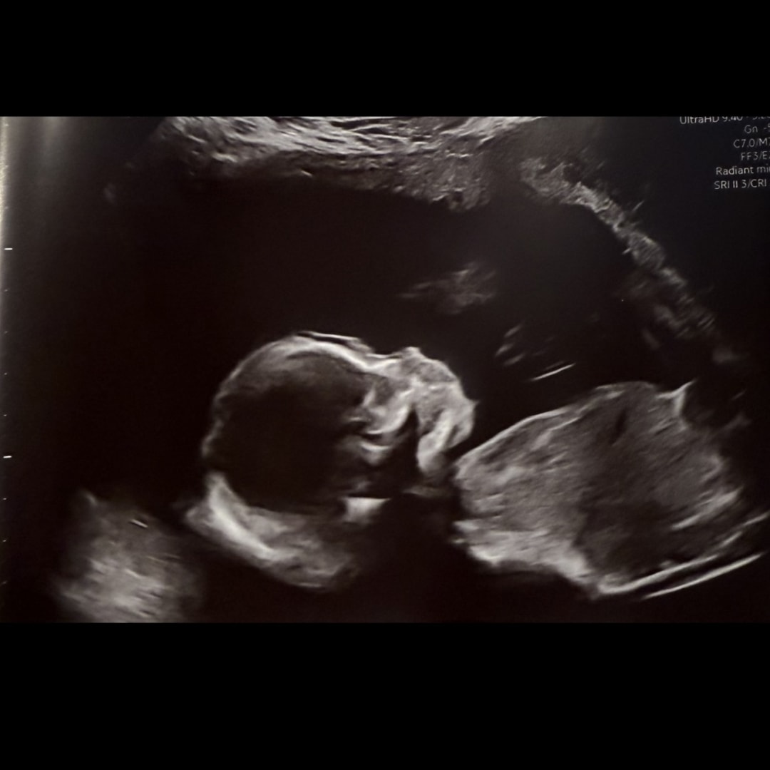 Photo shared by Anisah for their Babylist baby registry.