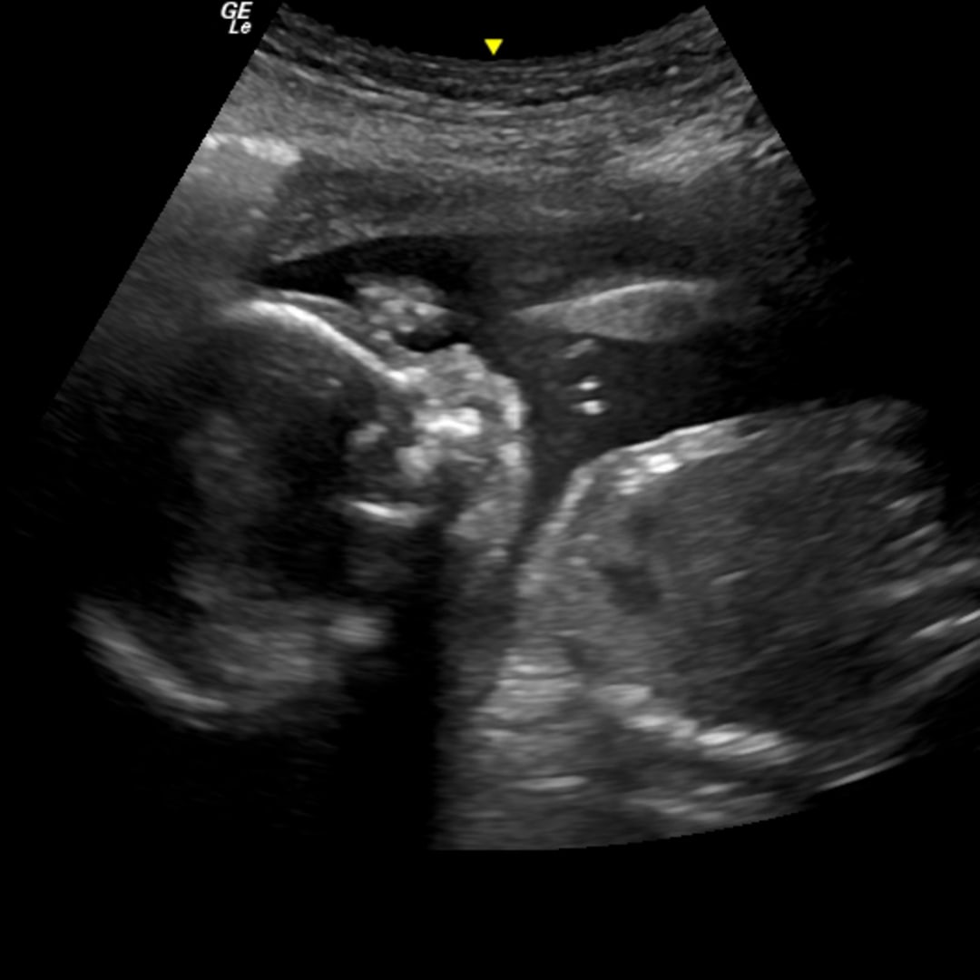 Photo shared by Aspen for their Babylist baby registry.