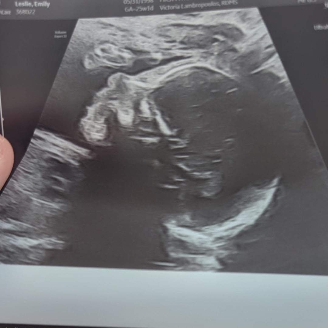 Photo shared by Emily for their Babylist baby registry.