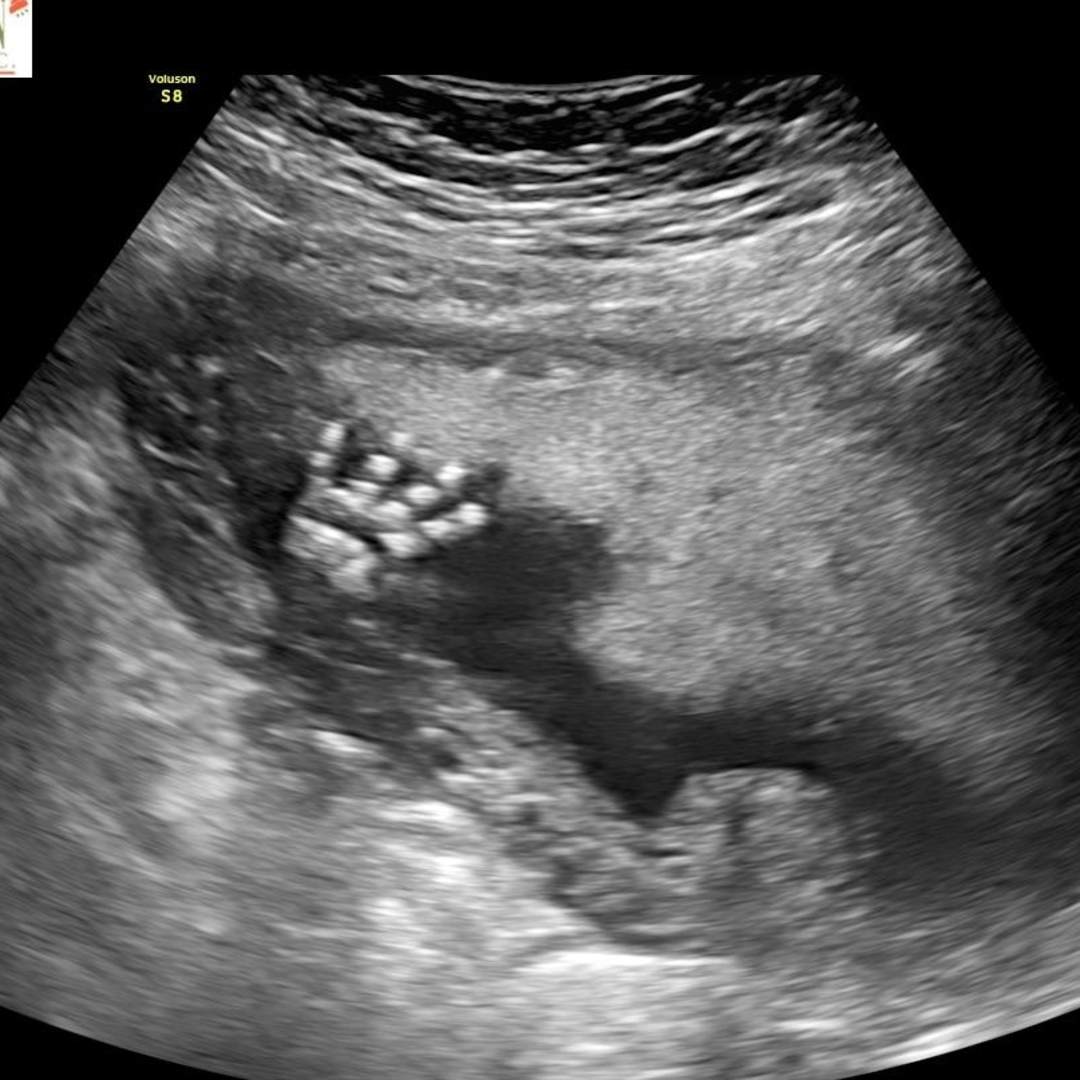 Photo shared by Paola for their Babylist baby registry.