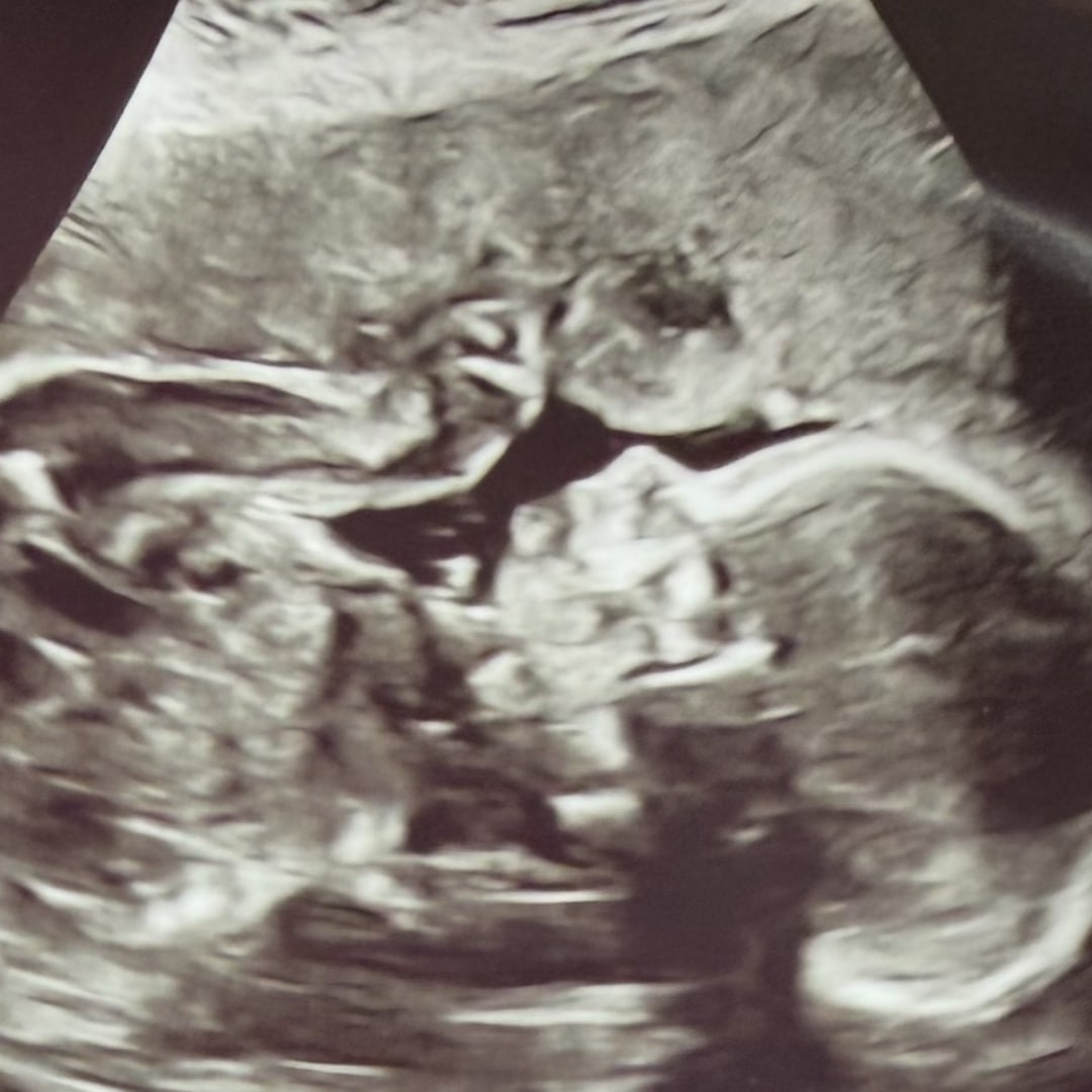 Photo shared by Ashley for their Babylist baby registry.