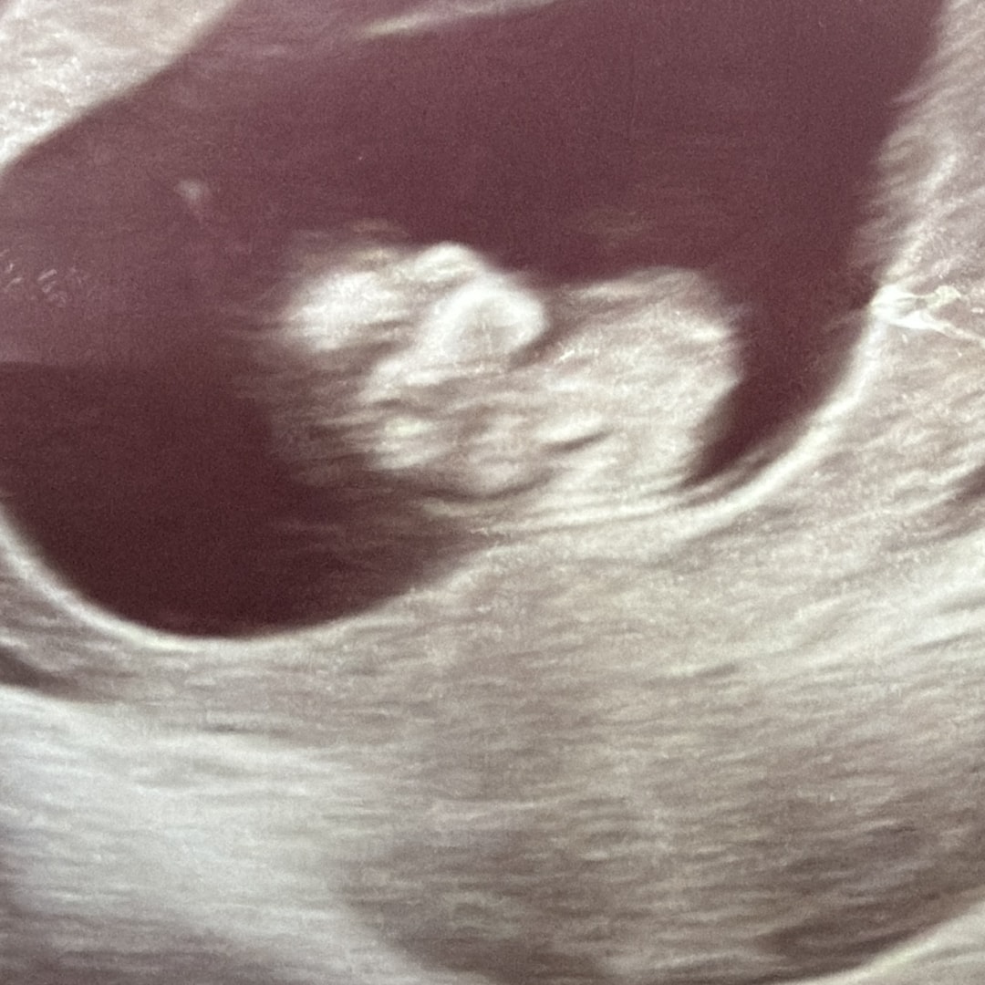 Photo shared by Brittany for their Babylist baby registry.