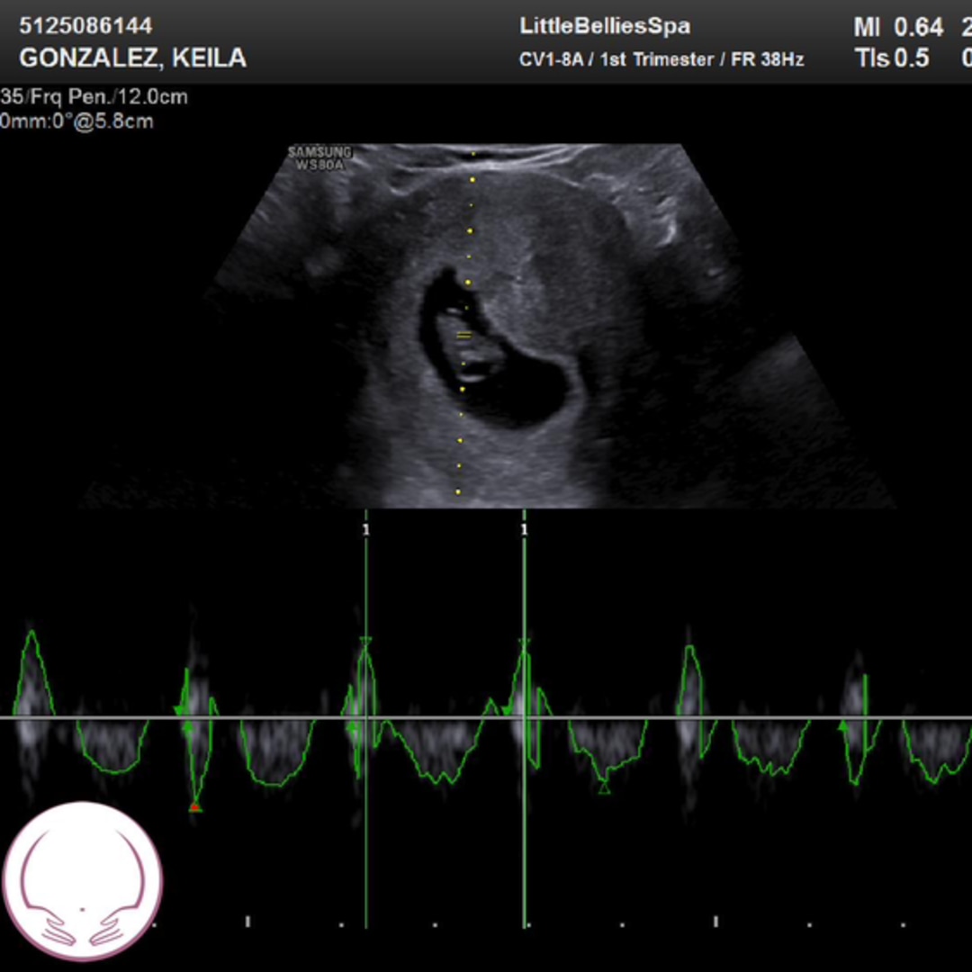 Photo shared by Keila for their Babylist baby registry.