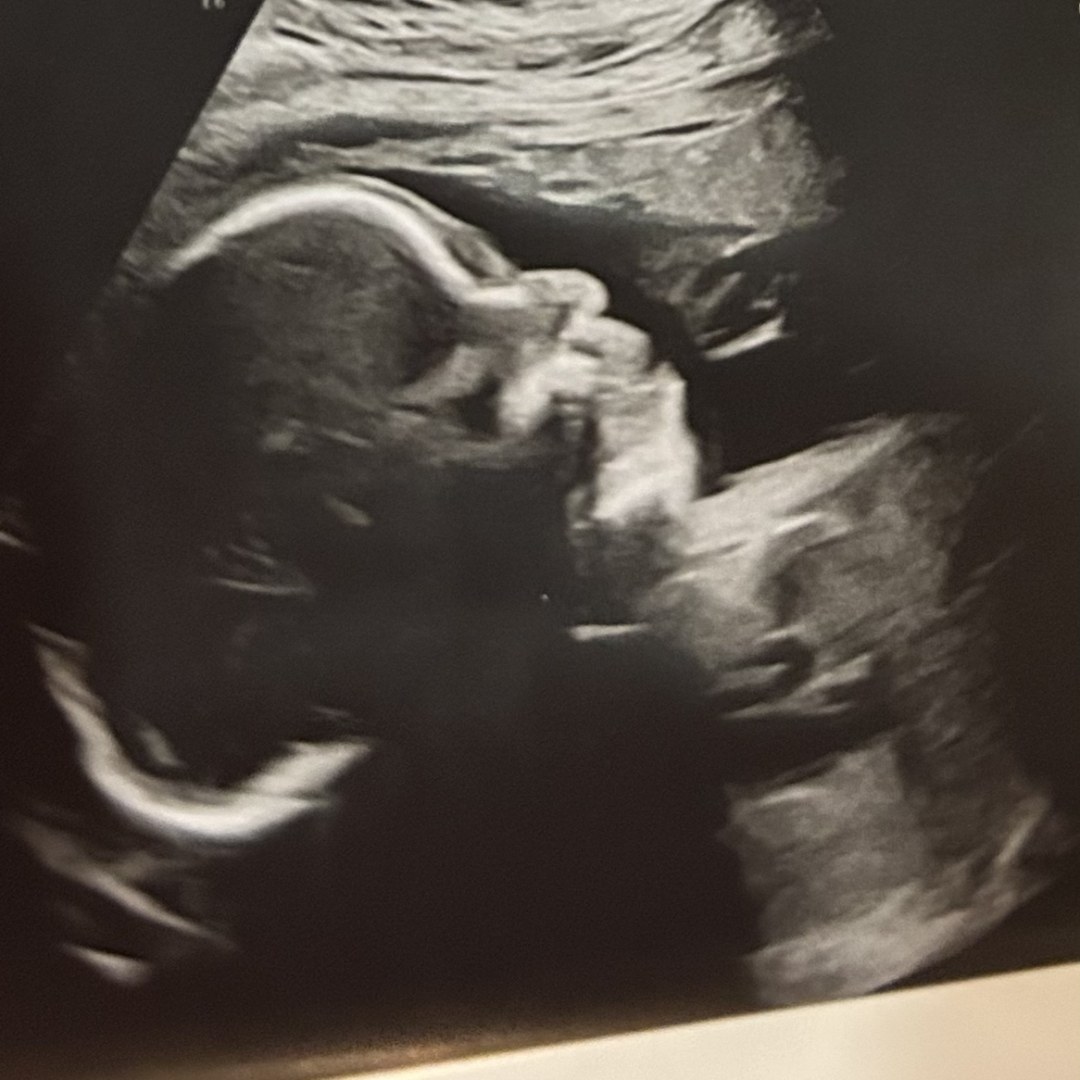 Photo shared by Bre for their Babylist baby registry.