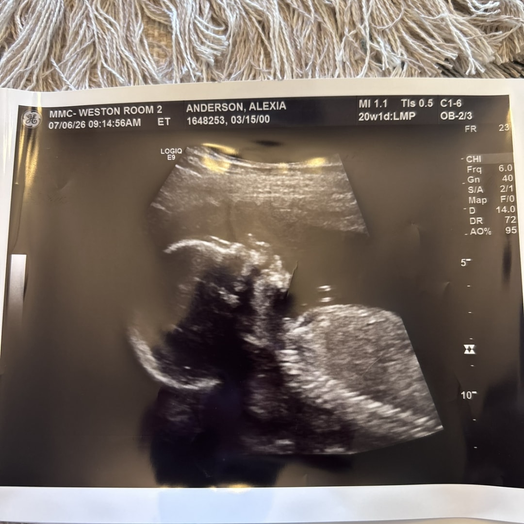 Photo shared by Alexia for their Babylist baby registry.