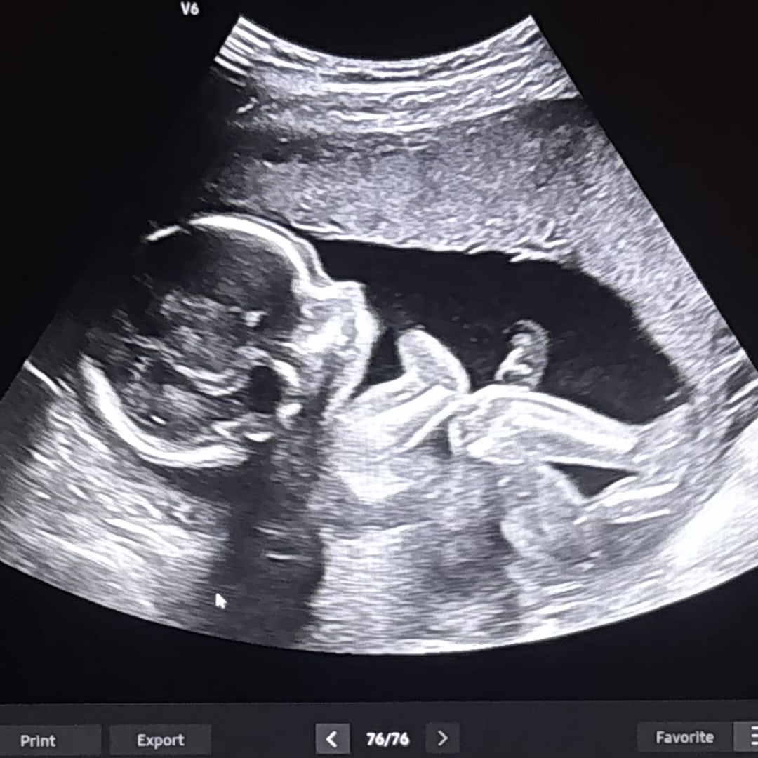 Photo shared by Madison for their Babylist baby registry.