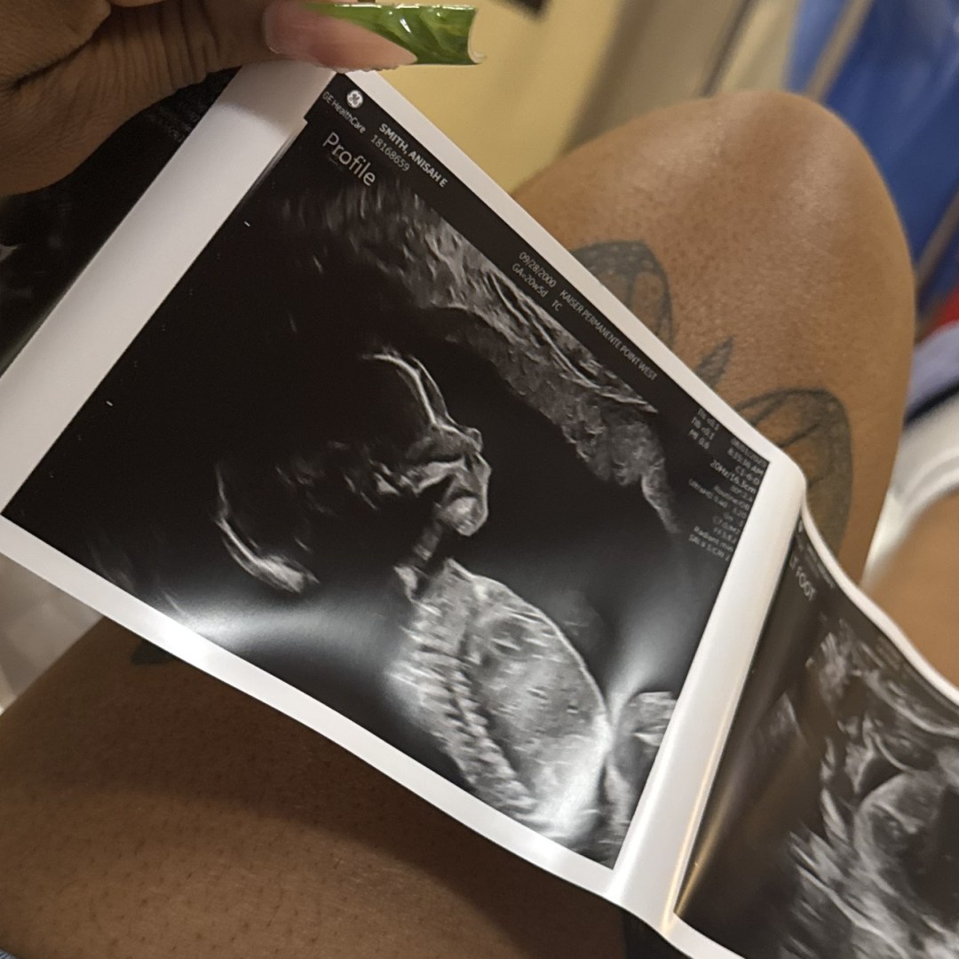 Photo shared by Anisah for their Babylist baby registry.