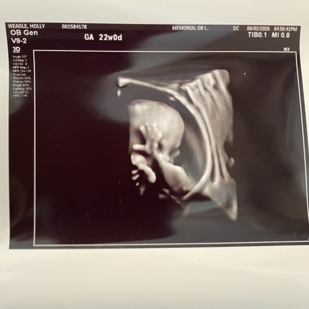 Photo shared by Holly for their Babylist baby registry.