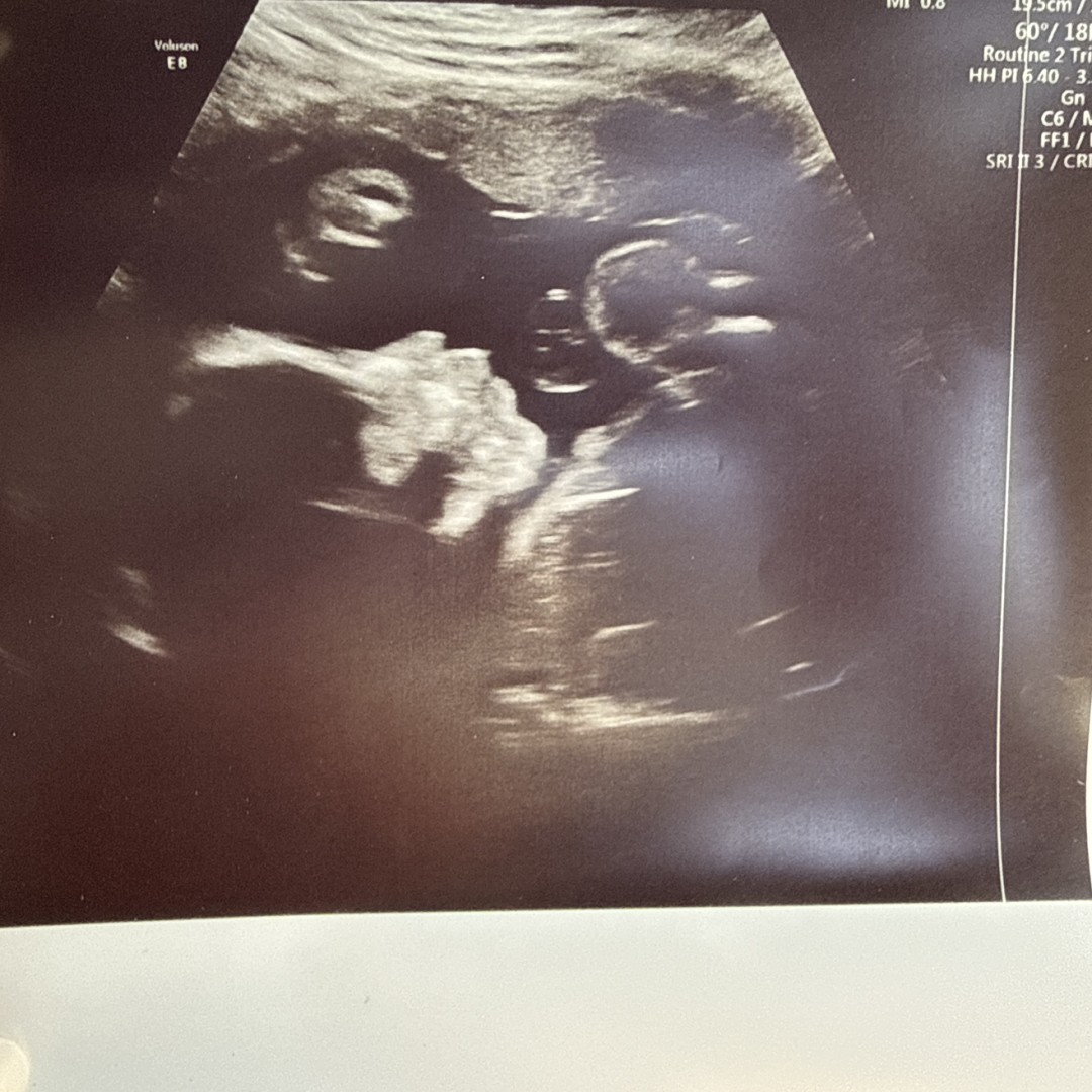 Photo shared by Morgan for their Babylist baby registry.