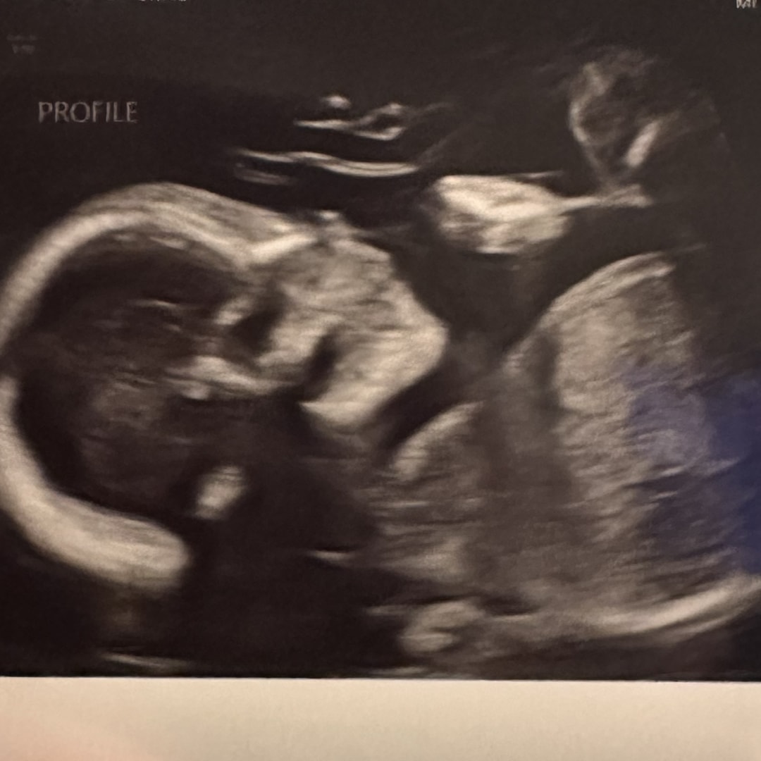 Photo shared by Jessica for their Babylist baby registry.