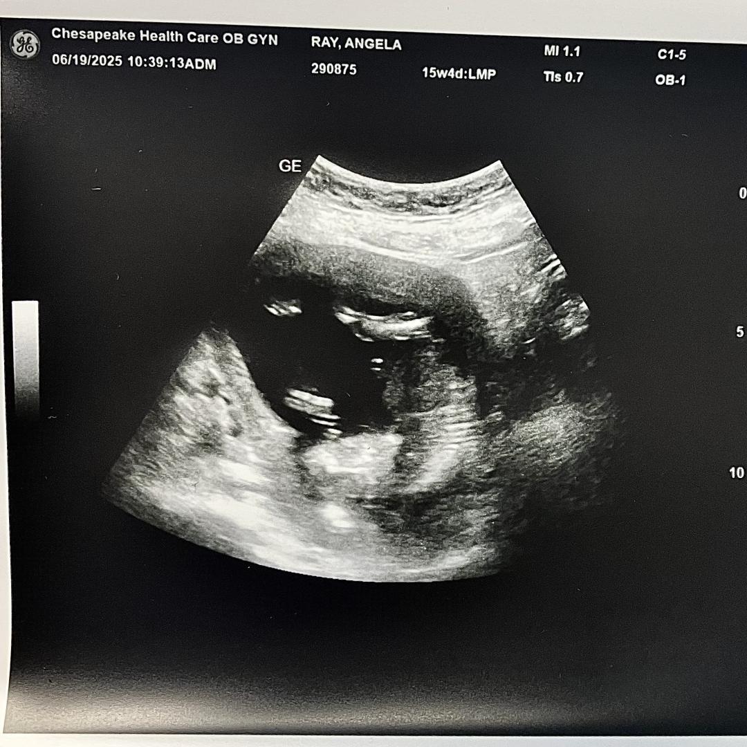 Photo shared by Angela for their Babylist baby registry.