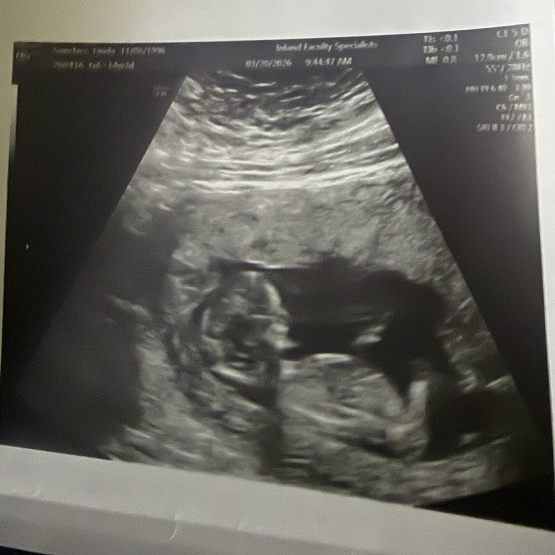 Photo shared by Linda for their Babylist baby registry.
