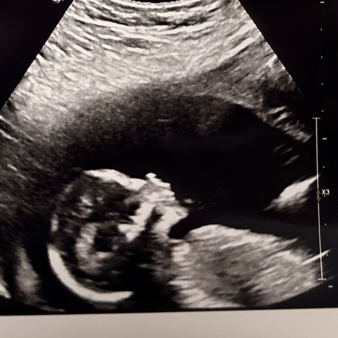 Photo shared by Isabel for their Babylist baby registry.