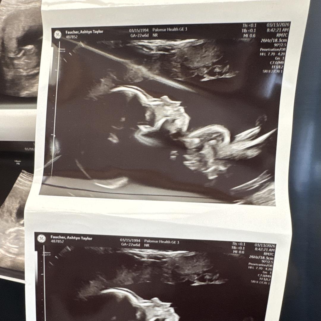 Photo shared by Ashtyn for their Babylist baby registry.