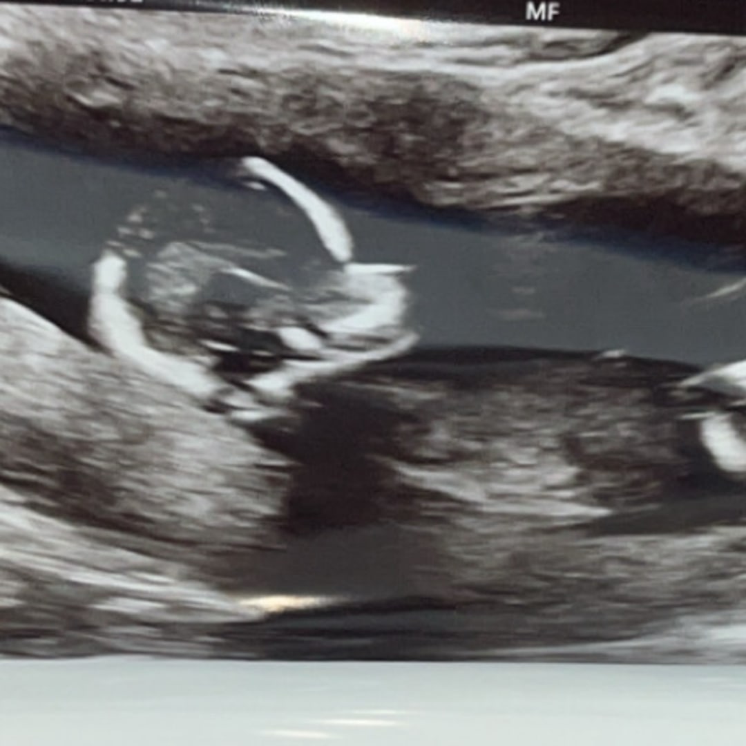 Photo shared by Sydney for their Babylist baby registry.