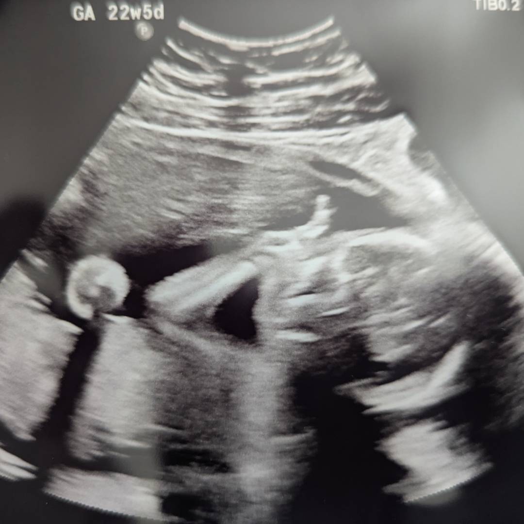 Photo shared by Sarah for their Babylist baby registry.