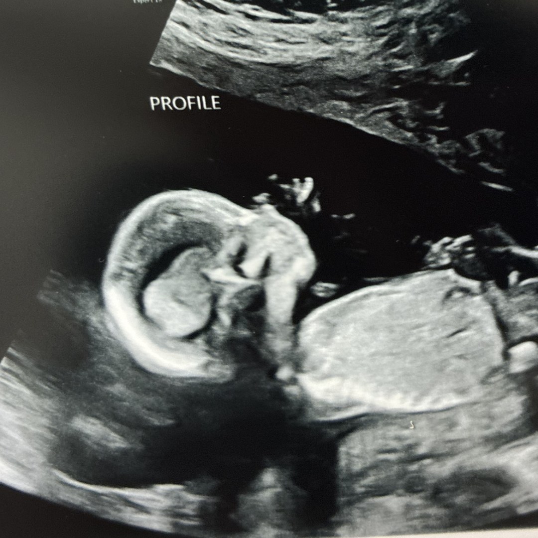 Photo shared by Christa for their Babylist baby registry.