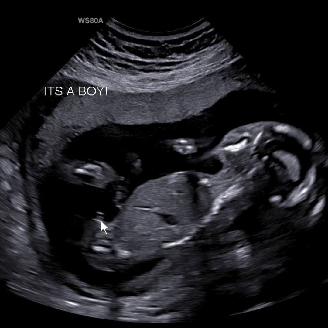 Photo shared by Erica for their Babylist baby registry.