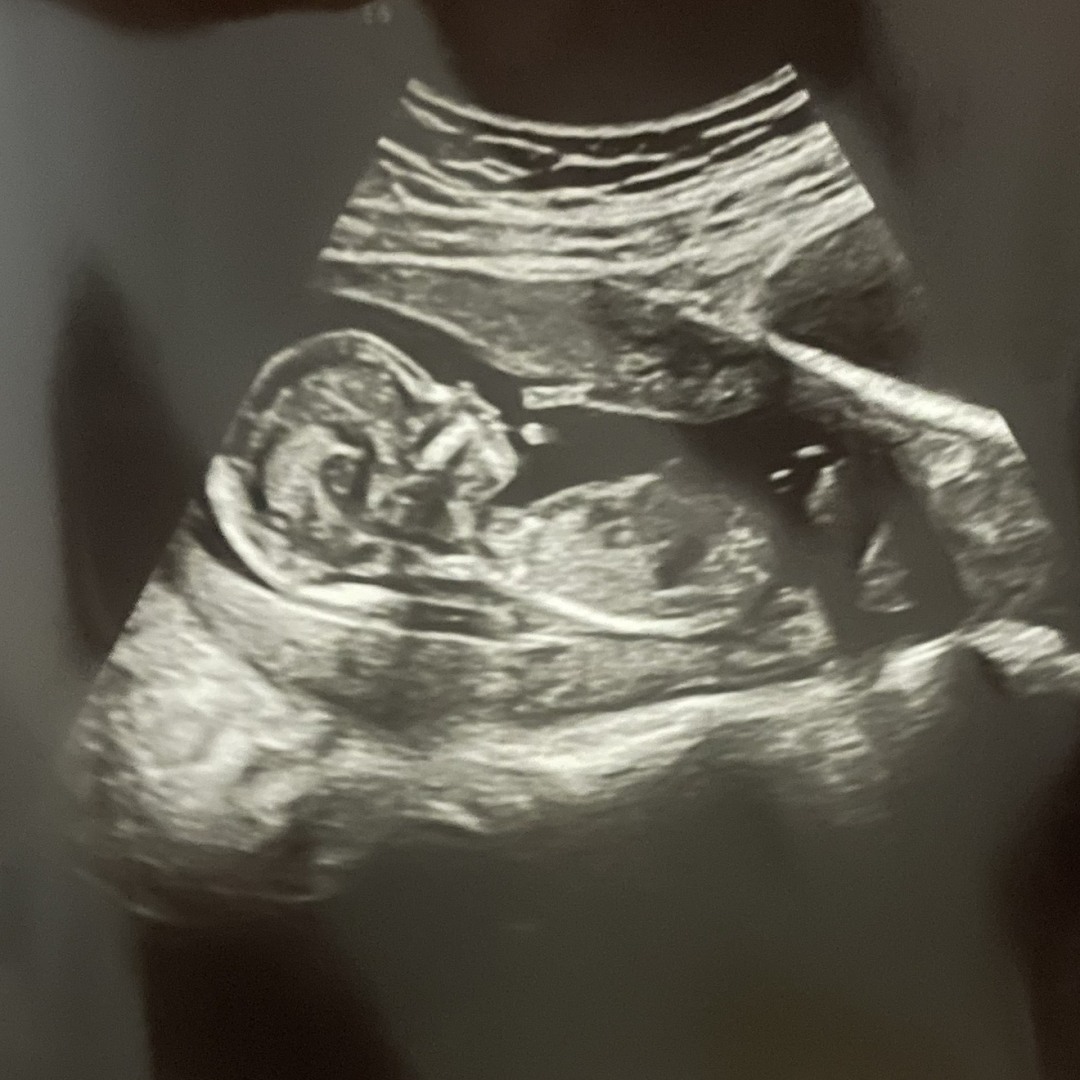 Photo shared by Kaitlyn for their Babylist baby registry.
