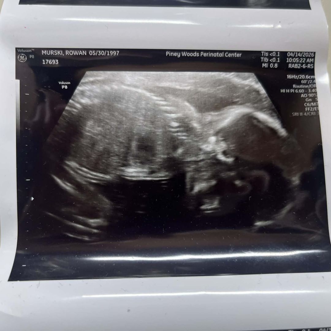 Photo shared by Rowan for their Babylist baby registry.