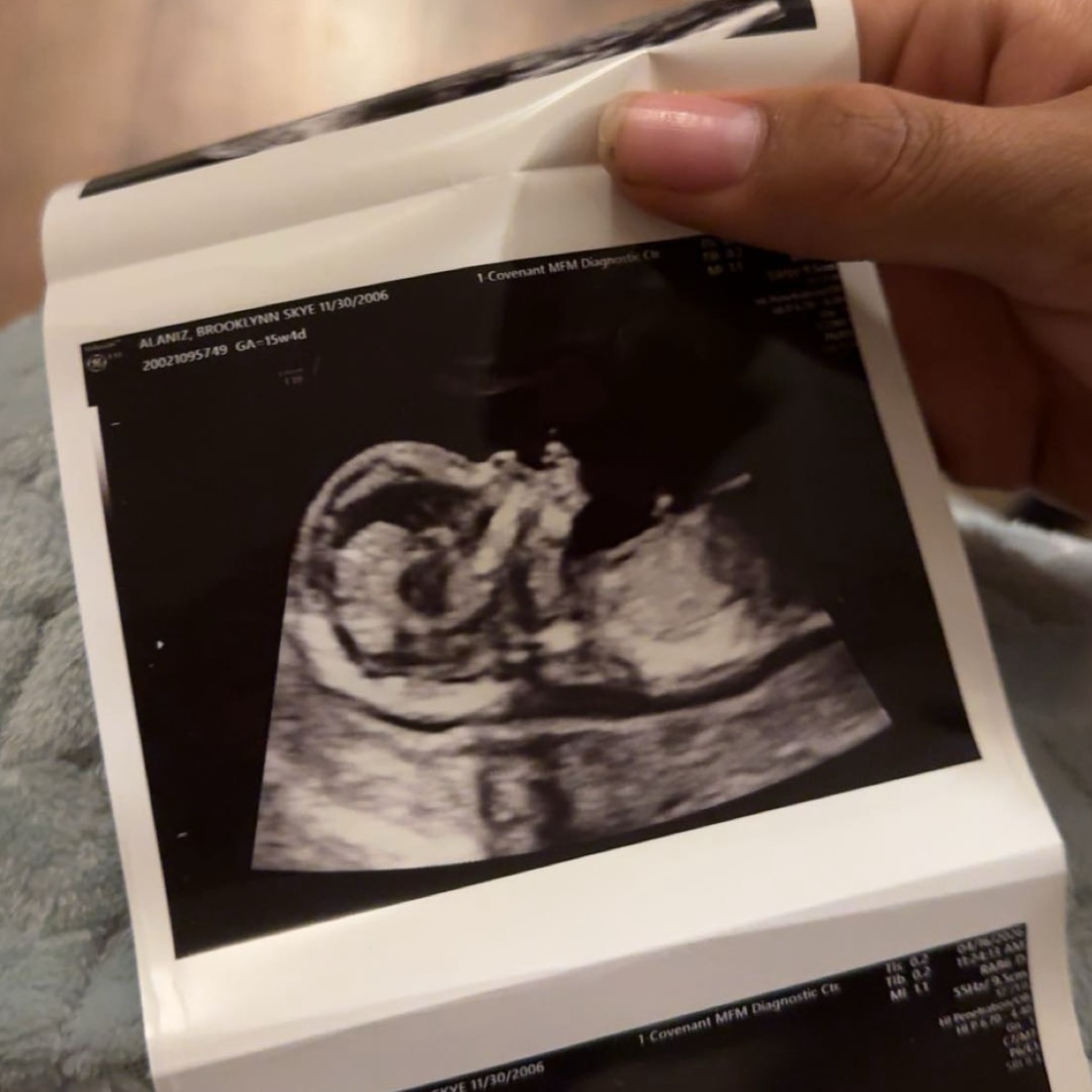 Photo shared by Brooklynn for their Babylist baby registry.