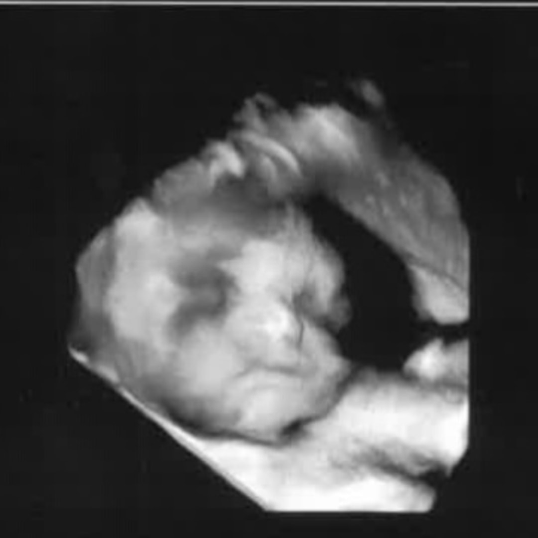 Photo shared by Payton for their Babylist baby registry.
