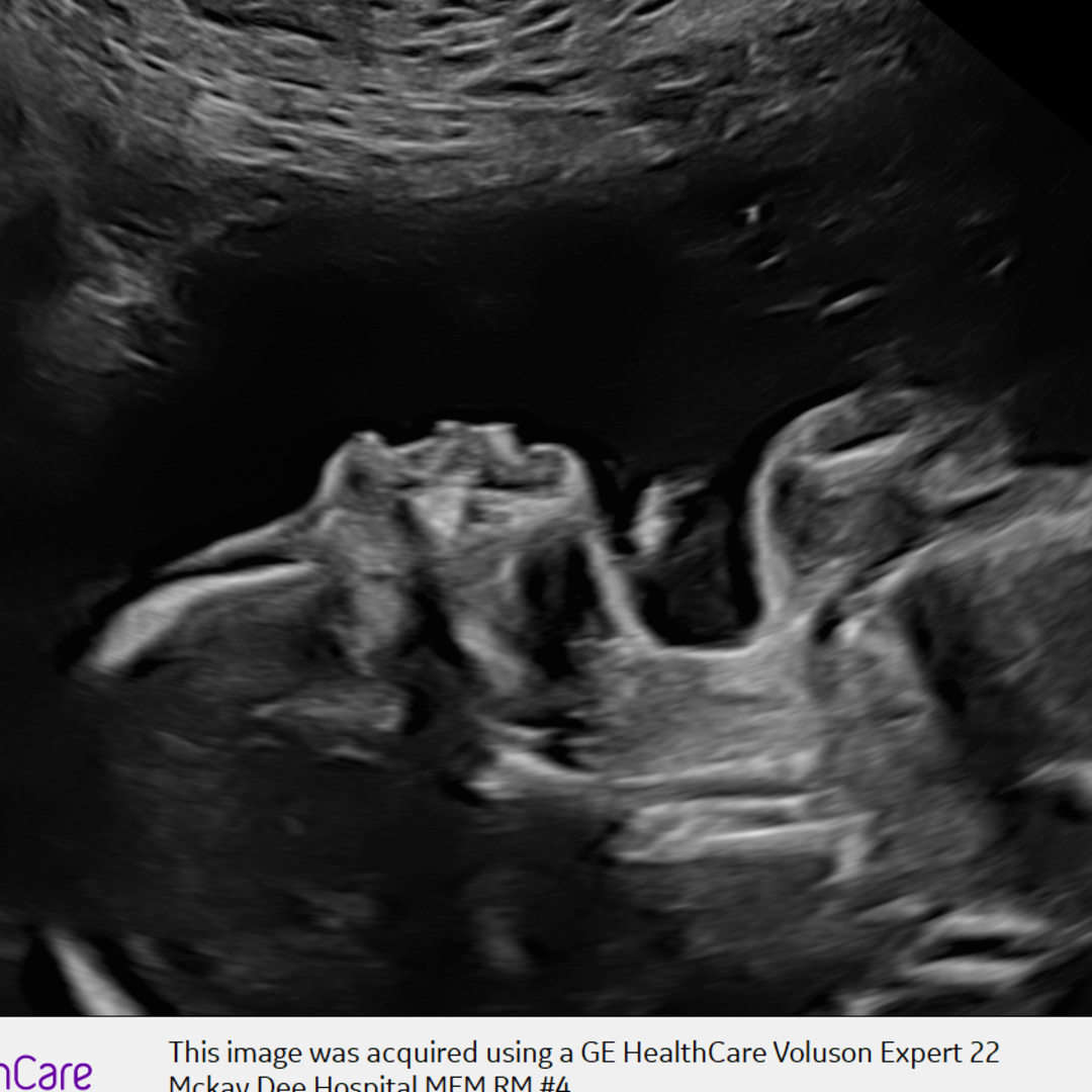 Photo shared by Jordan for their Babylist baby registry.