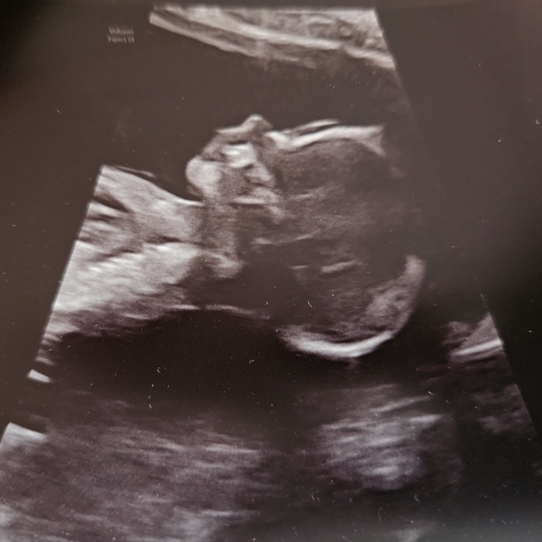 Photo shared by Kate for their Babylist baby registry.