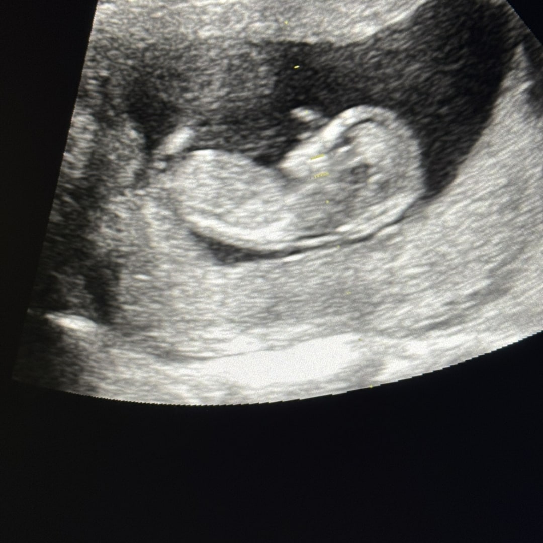 Photo shared by Tricia for their Babylist baby registry.