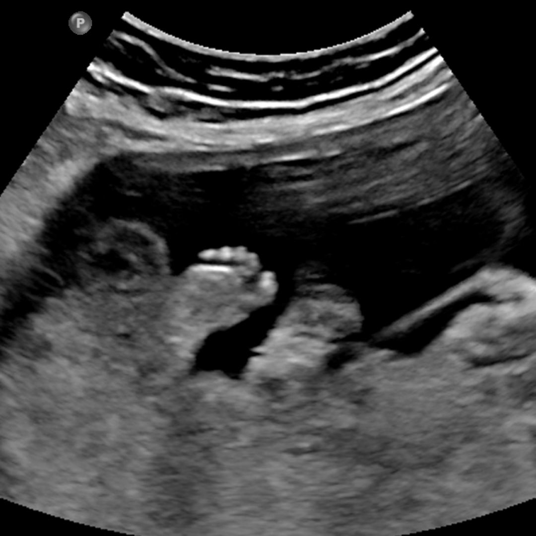 Photo shared by Veronica for their Babylist baby registry.