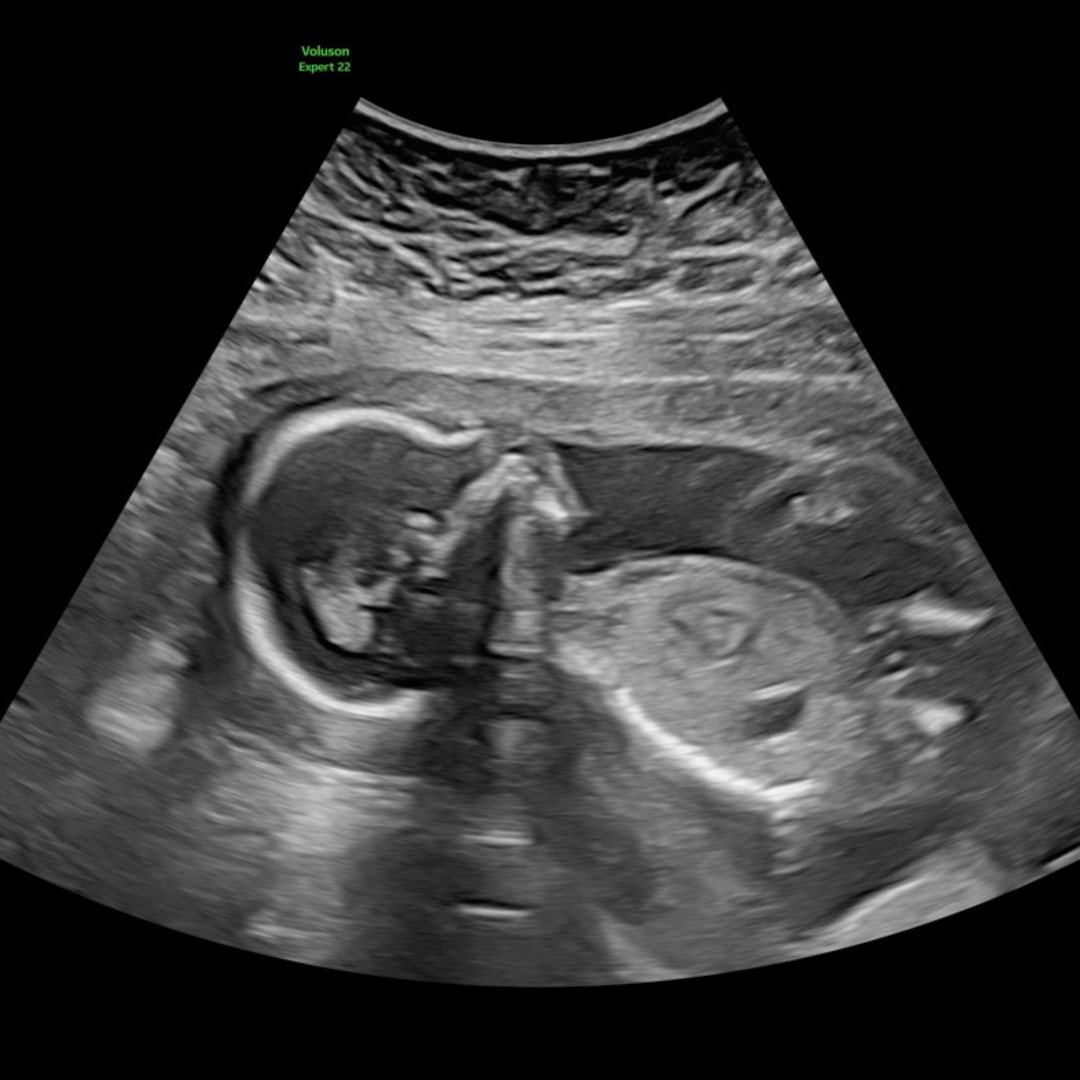 Photo shared by Abby for their Babylist baby registry.