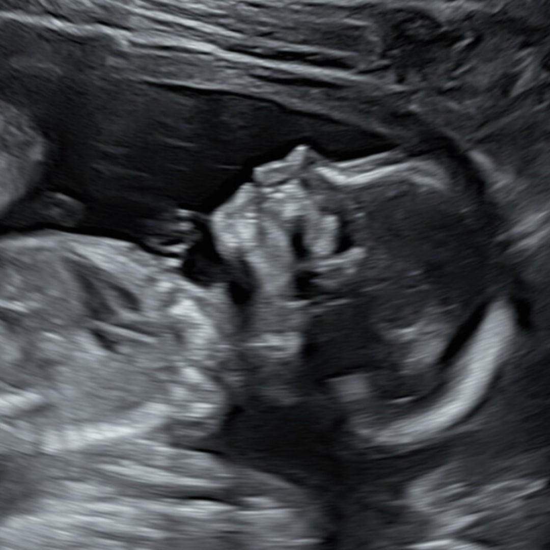 Photo shared by Alyona for their Babylist baby registry.