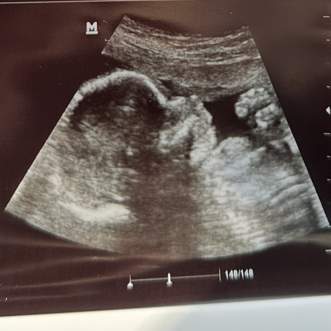 Photo shared by Andrew for their Babylist baby registry.