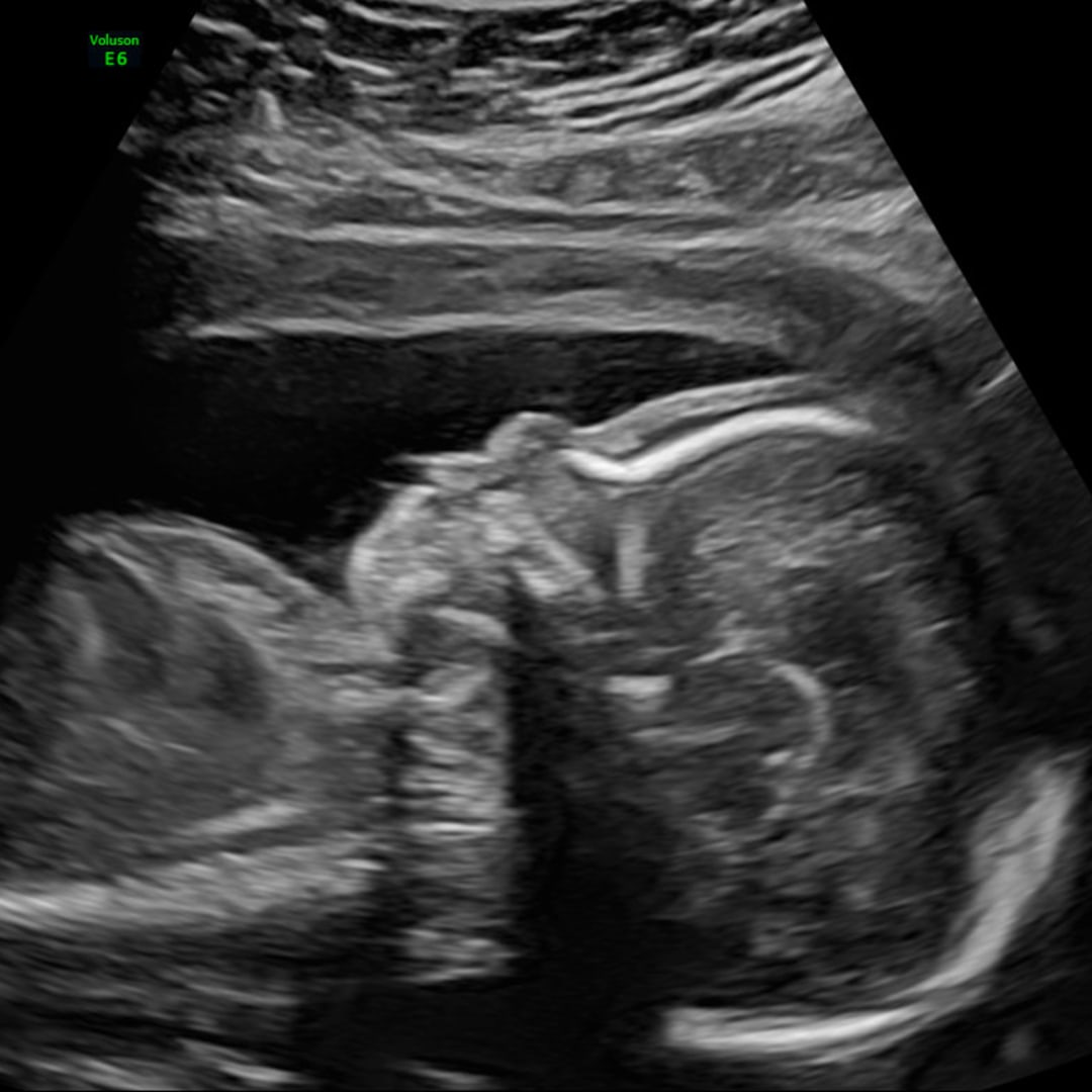 Photo shared by Lizzet for their Babylist baby registry.