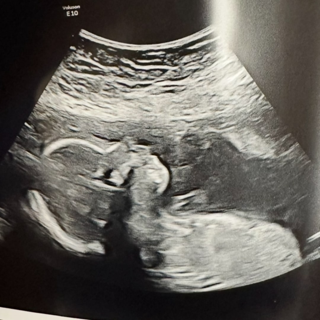 Photo shared by Gabrielle for their Babylist baby registry.