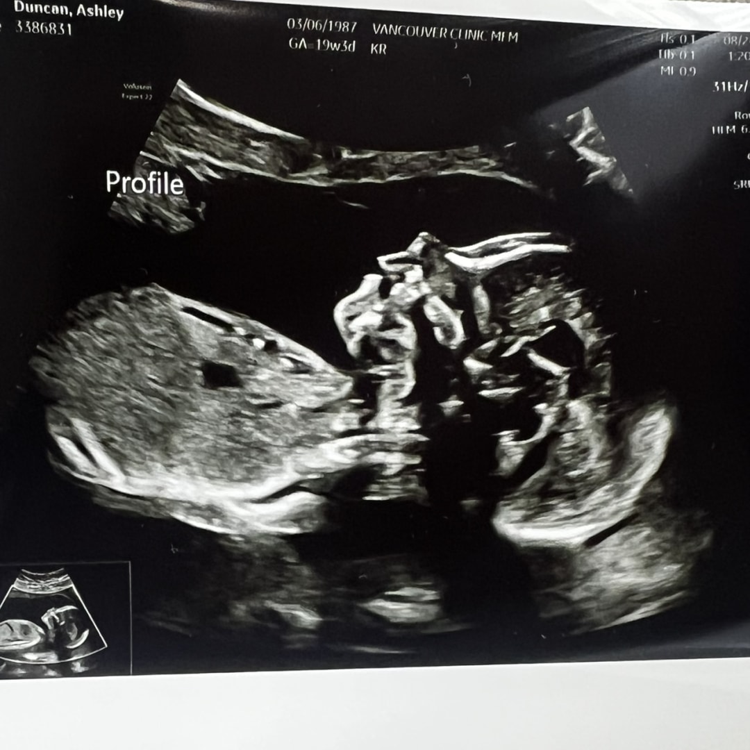 Photo shared by Ashley for their Babylist baby registry.