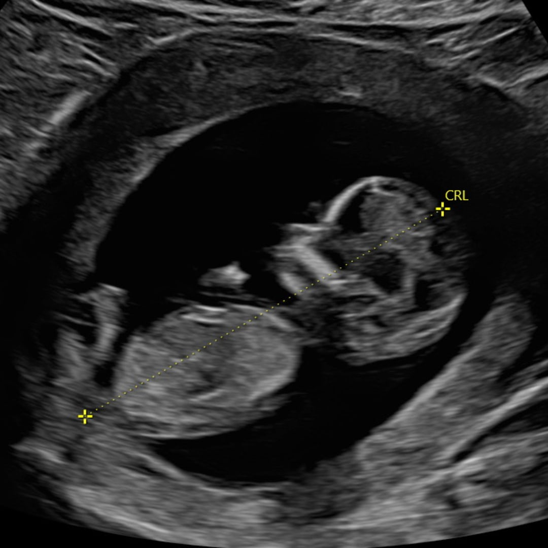 Photo shared by Stephanie for their Babylist baby registry.