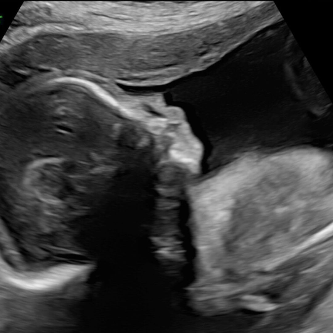 Photo shared by Hailey for their Babylist baby registry.