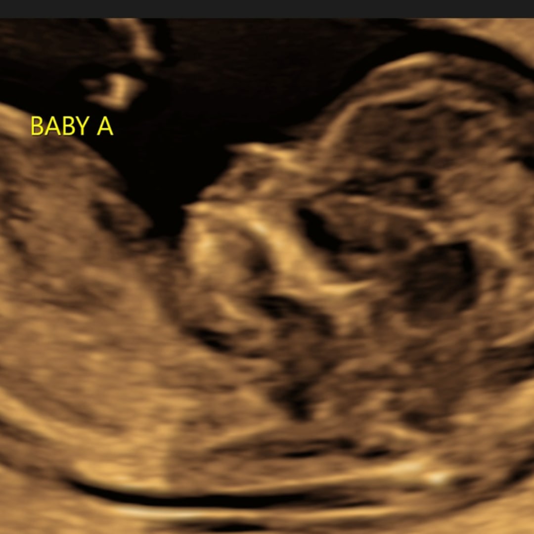 Photo shared by Sarah for their Babylist baby registry.