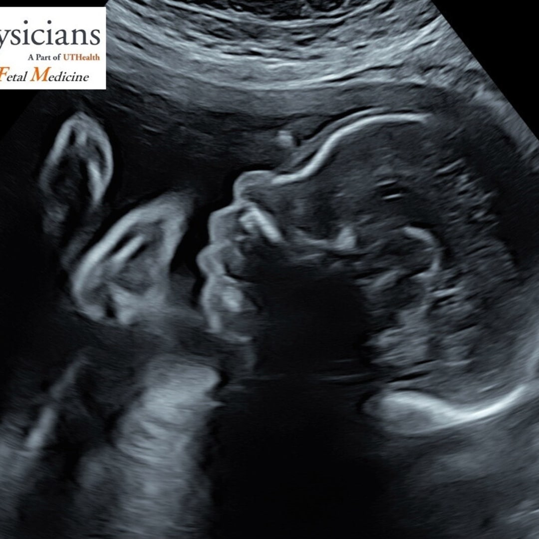 Photo shared by ✨ for their Babylist baby registry.