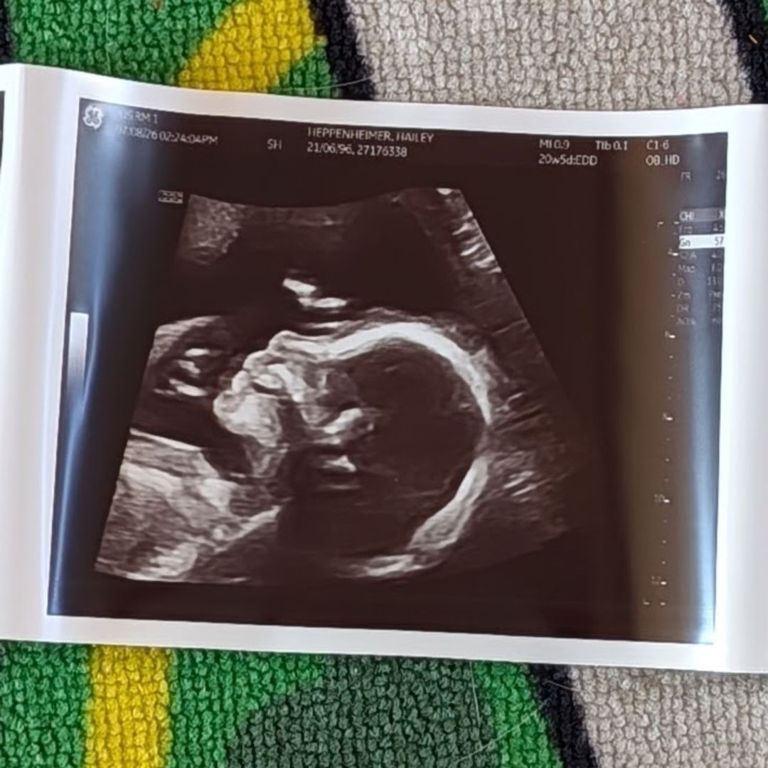 Photo shared by Hailey for their Babylist baby registry.