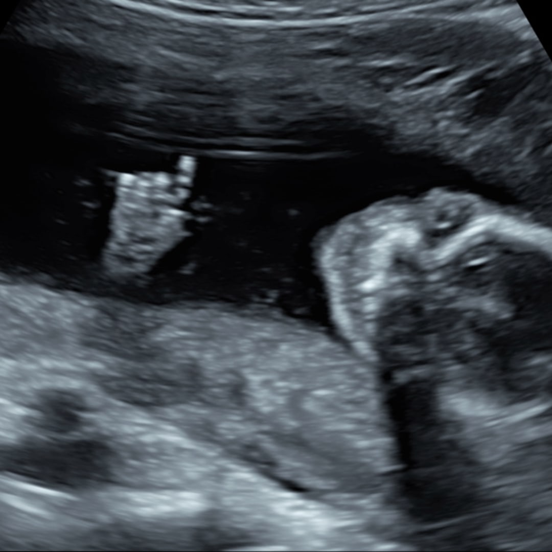 Photo shared by Mikayla for their Babylist baby registry.