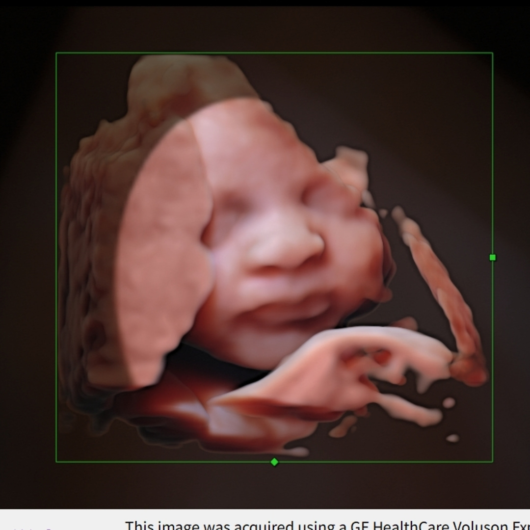 Photo shared by Brianna for their Babylist baby registry.